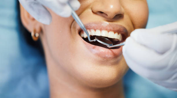 Best Emergency Dentist for Knocked-Out Tooth in Presquille, LA