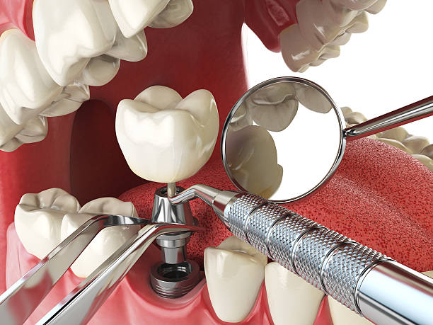 Best Pediatric Emergency Dentist in Presquille, LA