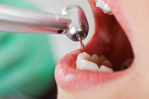 Best Mobile Emergency Dentist in Presquille, LA